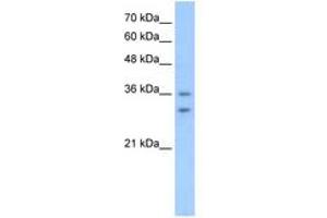 Image no. 1 for anti-Olfactory Receptor, Family 6, Subfamily C, Member 70 (OR6C70) (C-Term) antibody (ABIN205050) (OR6C70 Antikörper  (C-Term))