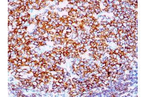 Formalin-fixed, paraffin-embedded human Tonsil stained with CD20 Rabbit Recombinant Monoclonal Antibody (IGEL/1497R). (Rekombinanter CD20 Antikörper)