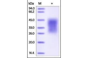 SDS-PAGE (SDS) image for Hepatitis A Virus Cellular Receptor 2 (TIM 3) (AA 22-200) (Active) protein (His tag) (ABIN2181817)