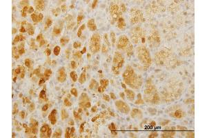 Immunoperoxidase of monoclonal antibody to TWIST2 on formalin-fixed paraffin-embedded human adrenal gland. (TWIST2 Antikörper  (AA 1-160))