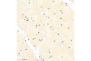 Immunohistochemistry (Paraffin-embedded Sections) (IHC (p)) image for anti-Cbp/p300-Interacting Transactivator, with Glu/Asp-Rich Carboxy-terminal Domain, 4 (CITED4) antibody (ABIN7073356)
