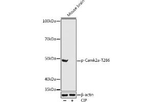 Western blot analysis of extracts of Mouse brain, using Phospho-Camk2a-T286 antibody (ABIN3019946, ABIN3019947, ABIN3019948 and ABIN1681430) at 1:1000 dilution. (CAMK2A Antikörper  (pThr286))