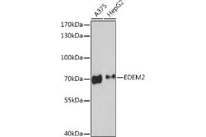 Western blot analysis of extracts of various cell lines, using EDEM2 Rabbit pAb (ABIN7267004) at 1:3000 dilution.