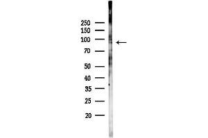 anti-Protein Phosphatase 1, Regulatory Subunit 9B, Spinophilin (PPP1R9B) (C-Term) antibody