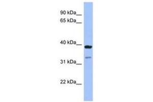 anti-Ras Association (RalGDS/AF-6) Domain Family (N-terminal) Member 7 (RASSF7) (AA 251-300) antibody