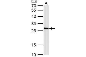 Western Blotting (WB) image for anti-Catechol-O-Methyltransferase (COMT) antibody (ABIN2854980)