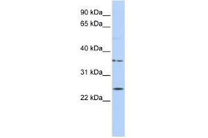 WB Suggested Anti-IQCF1 Antibody Titration: 0. (IQCF1 Antikörper  (Middle Region))