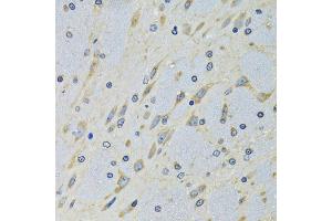 Immunohistochemistry of paraffin-embedded mouse brain using DARS antibody (ABIN5973949) at dilution of 1/100 (40x lens). (DARS Antikörper)