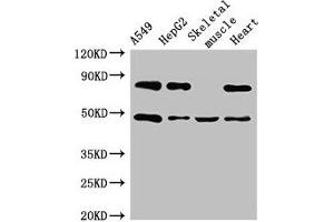 Western Blot Positive WB detected in: A549 whole cell lysate, HepG2 whole cell lysate, Mouse skeletal muscle tissue, Rat heart tissue All lanes: ASB4 antibody at 3 μg/mL Secondary Goat polyclonal to rabbit IgG at 1/50000 dilution Predicted band size: 49, 39 kDa Observed band size: 49 kDa (ASB4 Antikörper  (AA 166-321))