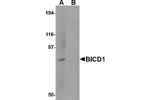 Western Blotting (WB) image for anti-Bicaudal D Homolog 1 (BICD1) (C-Term) antibody (ABIN1030294) (BICD1 Antikörper  (C-Term))