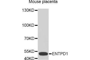 Western Blotting (WB) image for anti-Ectonucleoside Triphosphate diphosphohydrolase 1 (ENTPD1) (AA 1-180) antibody (ABIN1679729) (CD39 Antikörper  (AA 1-180))