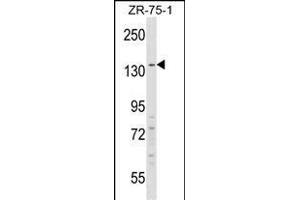 RFX1 Antibody (C-term) (ABIN1537643 and ABIN2848461) western blot analysis in ZR-75-1 cell line lysates (35 μg/lane).