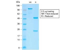 SDS-PAGE (SDS) image for anti-Catenin, beta (CATNB) antibody (ABIN5707937)