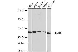 Western blot analysis of extracts of various cell lines, using PRMT6 Rabbit mAb (ABIN7269606) at 1:1000 dilution. (PRMT6 Antikörper)