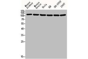 Western blot analysis of Mouse-kidney mouse-brain HELA KB SH-SY5Y 293T lysis using GCP5 antibody. (TUBGCP5 Antikörper  (Internal Region))