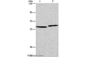 Western blot analysis of Human testis and prostate tissue, using HAS1 Polyclonal Antibody at dilution of 1:350
