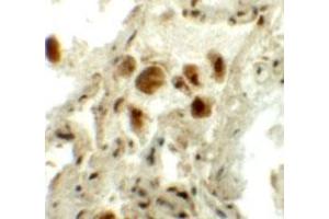 Immunohistochemical staining of human lung cells with RASSF10 polyclonal antibody  at 5 ug/mL. (RASSF10 Antikörper  (N-Term))