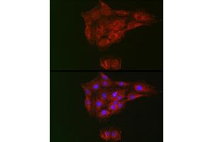 Immunofluorescence analysis of C6 cells using RTKN Rabbit pAb (ABIN6129097, ABIN6147290, ABIN6147292 and ABIN6222455) at dilution of 1:100 (40x lens).