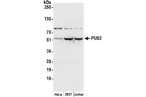 anti-Pseudouridylate Synthase 3 (PUS3) (AA 431-481) antibody