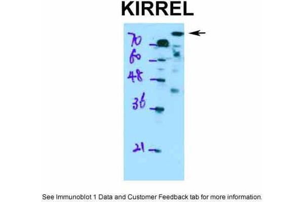 KIRREL Antikörper  (Middle Region)