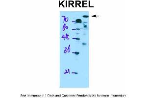 WB Suggested Anti-KIRREL Antibody Titration: 0. (KIRREL Antikörper  (Middle Region))