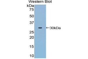 Western Blotting (WB) image for anti-Toll Interacting Protein (TOLLIP) (AA 28-261) antibody (ABIN1860826) (TOLLIP Antikörper  (AA 28-261))