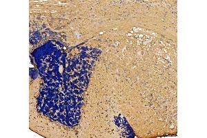 IHC analysis of Otofa/Otoferlin using anti-Otofa/Otoferlin antibody (ABIN7603818).