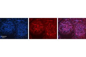 Rabbit Anti-ILF3 Antibody   Formalin Fixed Paraffin Embedded Tissue: Human Testis Tissue Observed Staining: Nucleus in spermatogonia and spermatocytes Primary Antibody Concentration: 1:100 Other Working Concentrations: 1:600 Secondary Antibody: Donkey anti-Rabbit-Cy3 Secondary Antibody Concentration: 1:200 Magnification: 20X Exposure Time: 0. (Interleukin enhancer-binding factor 3 (ILF3) (C-Term) Antikörper)