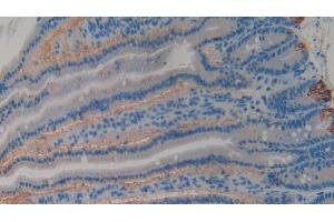 Immunohistochemistry (IHC) image for anti-Glycoprotein Ib (Platelet), beta Polypeptide (GP1BB) (AA 52-164) antibody (ABIN7439282)