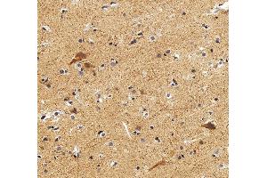 anti-Distal-Less Homeobox Protein 2 (DLX2) (AA 13-310) antibody