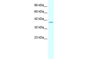 Image no. 1 for anti-H6 Family Homeobox 1 (HMX1) (Middle Region) antibody (ABIN2779760) (HMX1 Antikörper  (Middle Region))