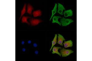 ABIN6258617 and ABIN6274962 staining Hela cells by IF/ICC. (CA5B Antikörper  (C-Term))