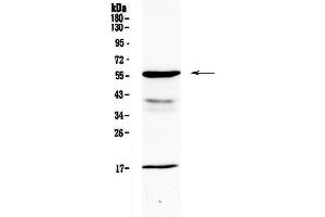 Western blot analysis of GALNS using anti-GALNS antibody . (GALNS Antikörper  (AA 181-289))