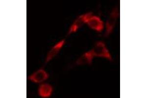 ABIN6274420 staining LOVO cells by IF/ICC. (LMTK2 Antikörper  (Internal Region))