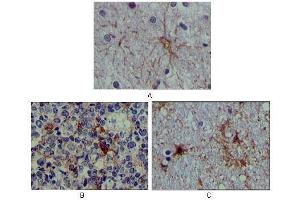 Immunohistochemical analysis of paraffin-embedded human brain tissue (A), lymphoid follicles tissue (B) and interbrain tissue (C), showing cytoplasmic localization using S100A mouse mAb with DAB staining. (S100A1 Antikörper)
