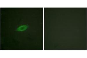 Immunofluorescence analysis of HeLa cells, using Annexin A6 Antibody.