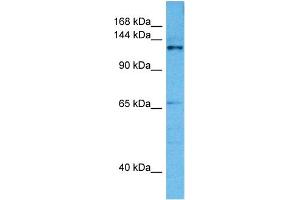 Host:  Mouse  Target Name:  CASZ1  Sample Tissue:  Mouse Pancreas  Antibody Dilution:  1ug/ml (CASZ1 Antikörper  (Middle Region))