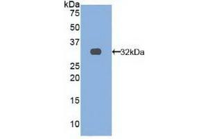 Detection of Recombinant TRAF4, Human using Polyclonal Antibody to TNF Receptor Associated Factor 4 (TRAF4) (TRAF4 Antikörper  (AA 193-444))