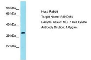 Image no. 1 for anti-R3H Domain Containing 4 (R3HDM4) (AA 45-94) antibody (ABIN6750725) (R3HDM4 Antikörper  (AA 45-94))