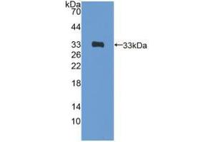 Western blot analysis of recombinant Rat GATA4. (GATA4 Antikörper  (AA 228-440))