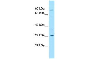 Host:  Rabbit  Target Name:  Foxk1  Sample Type:  Rat Thymus lysates  Antibody Dilution:  1.