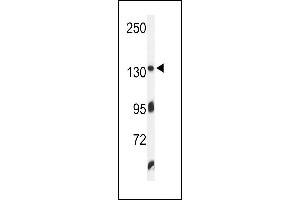 Western blot analysis of ZO1 Antibody (C-term) (ABIN650980 and ABIN2840020) in K562 cell line lysates (35 μg/lane). (TJP1 Antikörper  (C-Term))