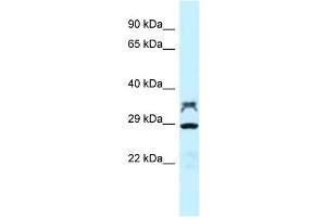 WB Suggested Anti-LOC100362453 Antibody Titration: 1. (LOC100362453 Antikörper  (C-Term))