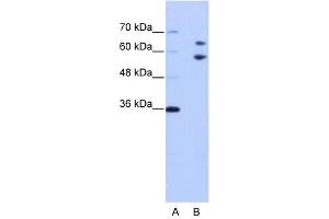 TROVE2 antibody used at 1 ug/ml to detect target protein. (TROVE2 Antikörper  (N-Term))