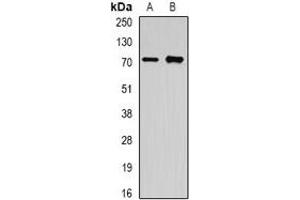 Western blot analysis of OLFM1 expression in A549 (A), mouse brain (B) whole cell lysates. (Olfactomedin 1 Antikörper)