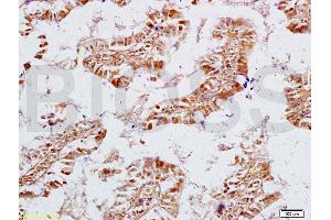 Formalin-fixed and rat intestine tissue labeled with Anti-NPY/Neuropeptide Y Polyclonal Antibody, Unconjugated (ABIN673134) at 1:200 followed by conjugation to the secondary antibody and DAB staining