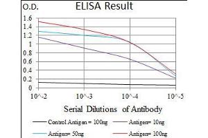 Black line: Control Antigen (100 ng), Purple line: Antigen(10 ng), Blue line: Antigen (50 ng), Red line: Antigen (100 ng), (GUCY1A1 Antikörper  (AA 22-214))