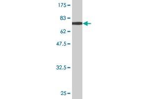 Western Blot detection against Immunogen (70. (Aminoacylase 1 Antikörper  (AA 1-408))