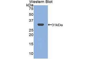 Western Blotting (WB) image for anti-B-Cell Linker (BLNK) (AA 65-314) antibody (ABIN1858143) (B-Cell Linker Antikörper  (AA 65-314))