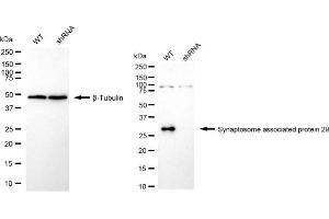 Western blotting analysis using Synaptosome associated protein 29 antibody (ABIN7800488). (Rekombinanter SNAP29 Antikörper)